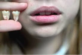 Ağıl dişi ilə insanın “ağlı” arasında əlaqə varmı?