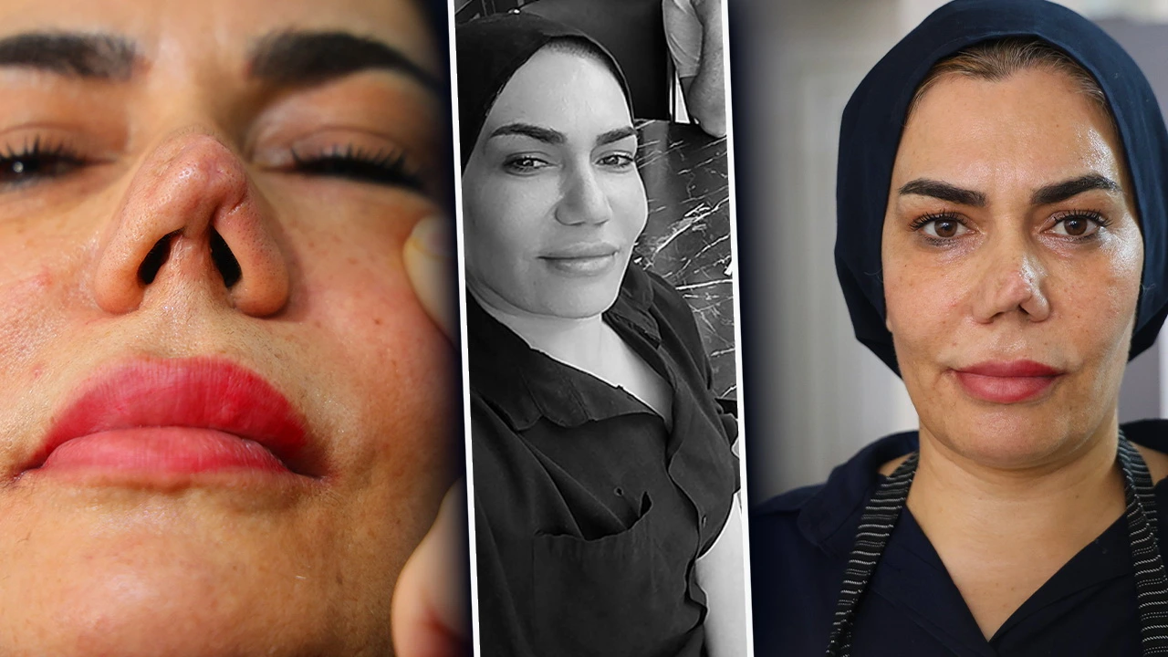 Aynaya baxa bilməz hala gəldi - 2 uşaq anasının həyatı kabusa çevrildi