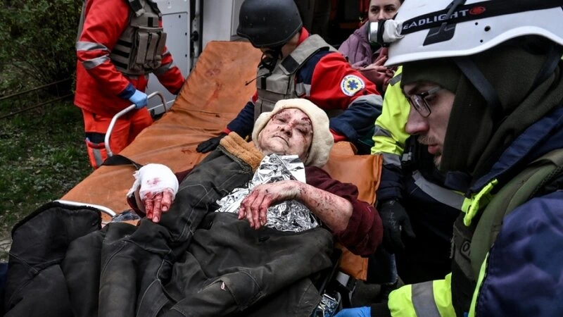 Rusiyanın hücumu nəticəsində Zaporojyedə yaralananların sayı 30 nəfərə çatdı