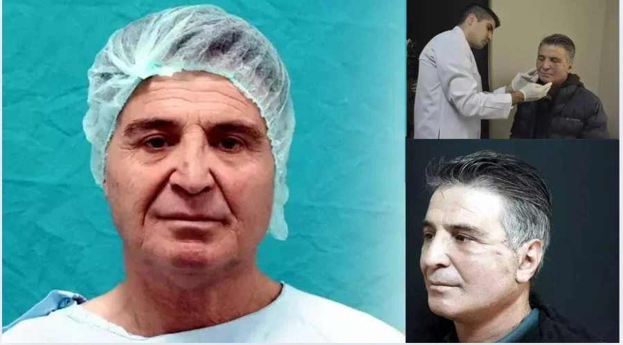 Dövlət xəstəxanasında bir ilk!&nbsp;Əməliyyatdan 15 il cavanlaşaraq çıxdı