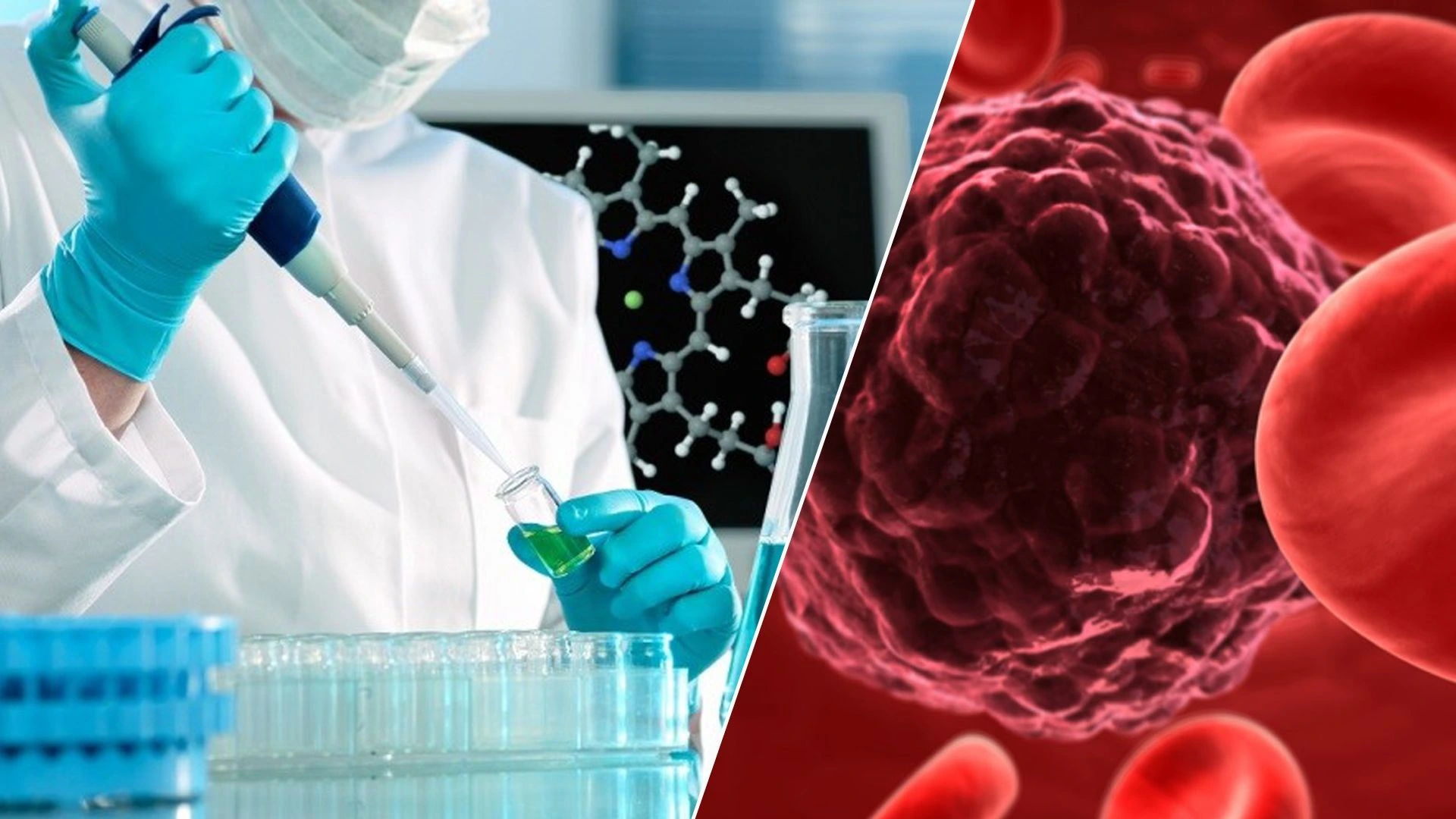 Xərçəng müalicəsində yeni araşdırma