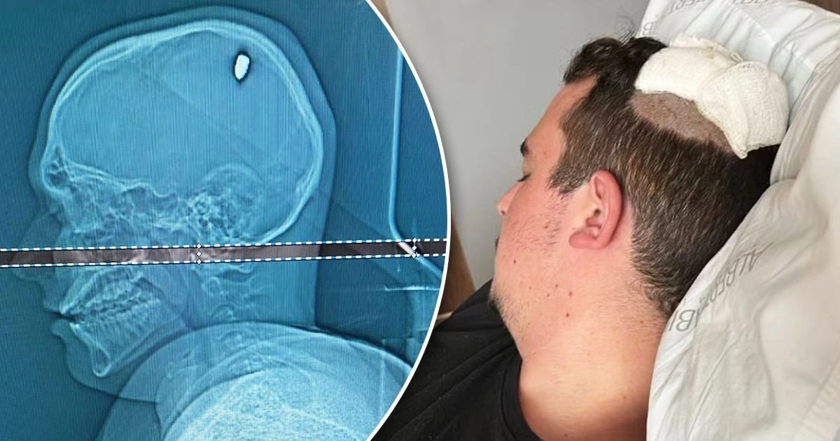 1 sutka başında güllə ilə gəzən kişi - əməliyyat olundu