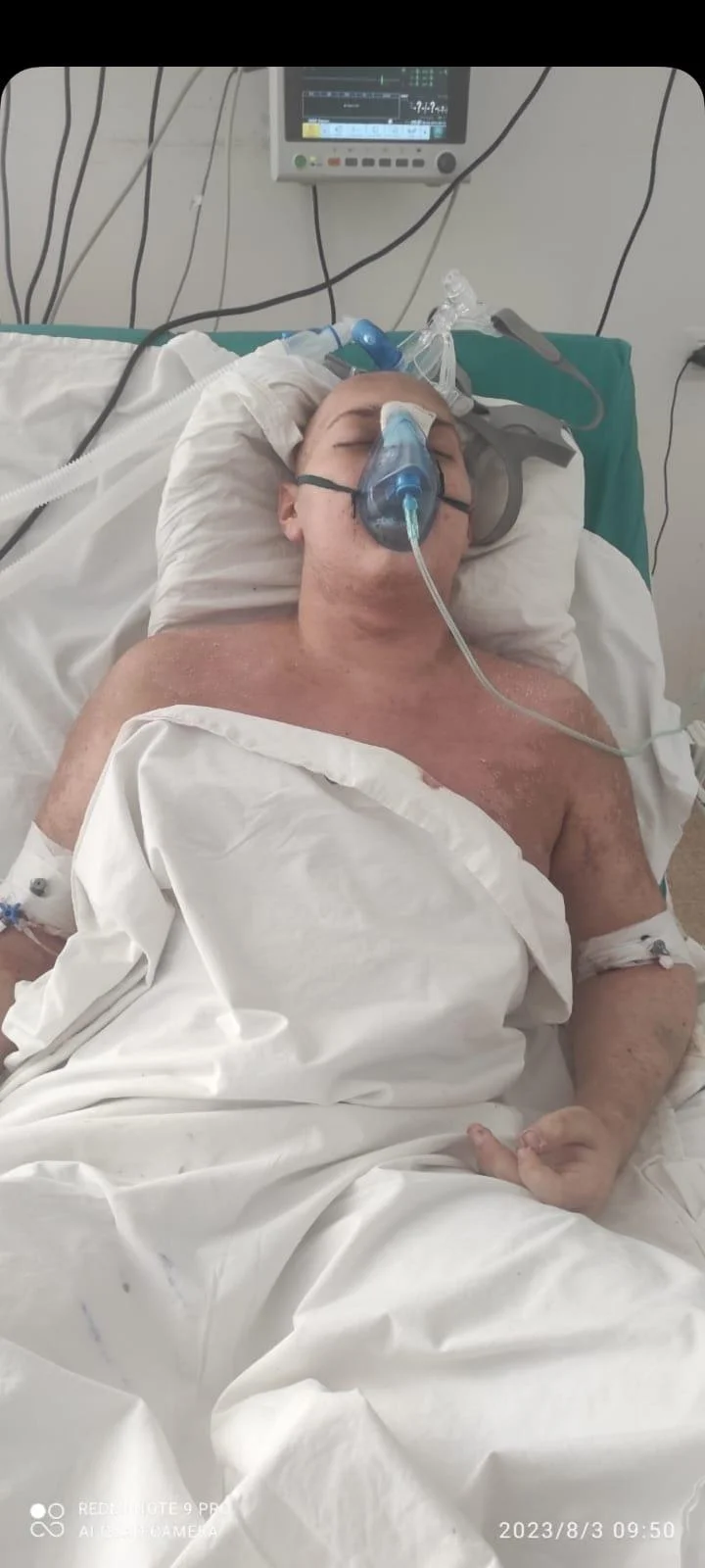 16 yaşlı Əjdər Quluzadə leykoz xəstəsidir, ana kömək istəyir -FOTOLAR