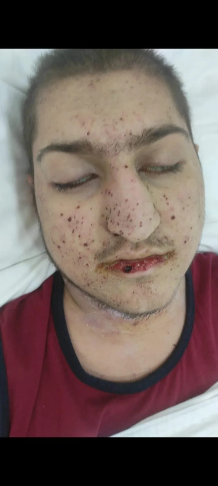 16 yaşlı Əjdər Quluzadə leykoz xəstəsidir, ana kömək istəyir -FOTOLAR