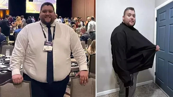 238 kilo ilə insult keçirdi, 68 kilo verdi: Həyatını xilas edən vərdiş