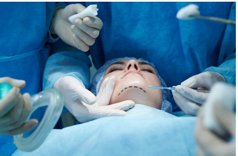 Estetik əməliyyatlar niyə tibbdən çıxıb sosial problemə çevrildi? - TƏHLİL