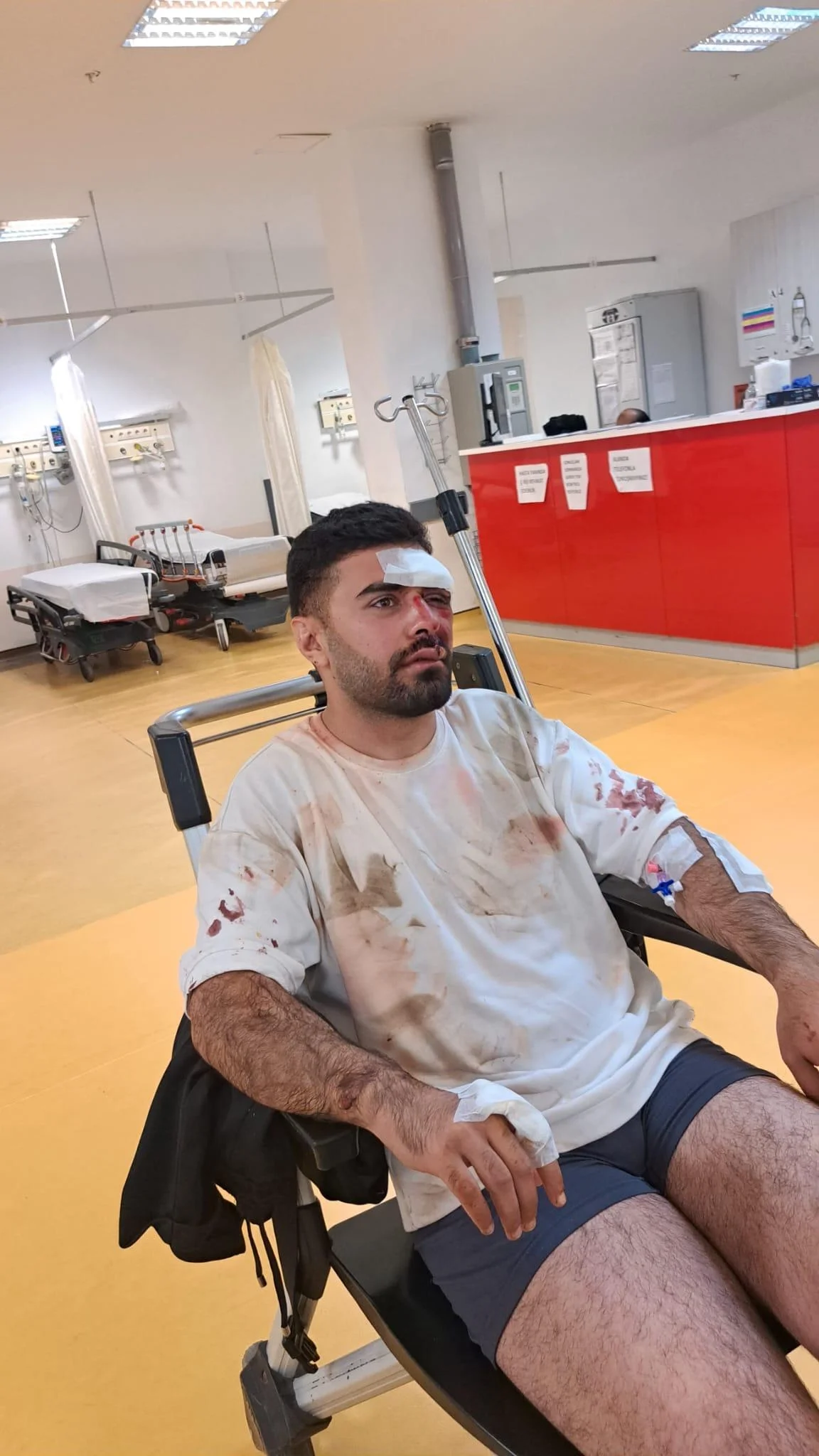 Rəvan Cavid motosiklet qəzasında ağır yaralandı - Fotolar