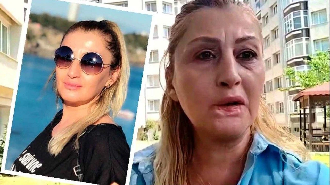 Dolğudan sonra dodağı çürüdü: “Nə gülə bilirəm, nə də rahat yemək yeyə"