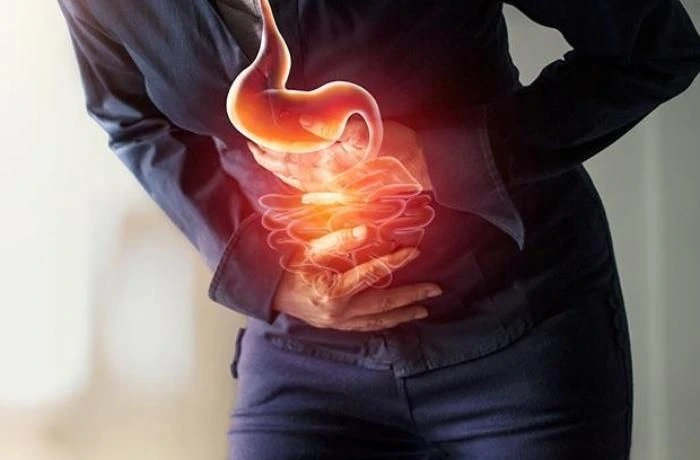 Mədə yanması – Həmişə qastrit deməkdirmi?