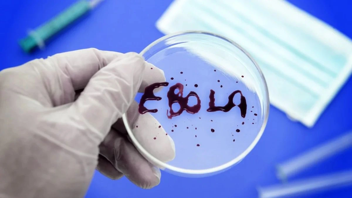 Ebola virusundan qorunmağın əsas yolu sosial davranışlardır -&nbsp;Həkim-infeksionist