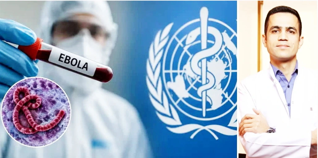 Çiy ət və dəfn mərasimləri: İnfeksionist Ebola ilə bağlı riskləri açıqladı