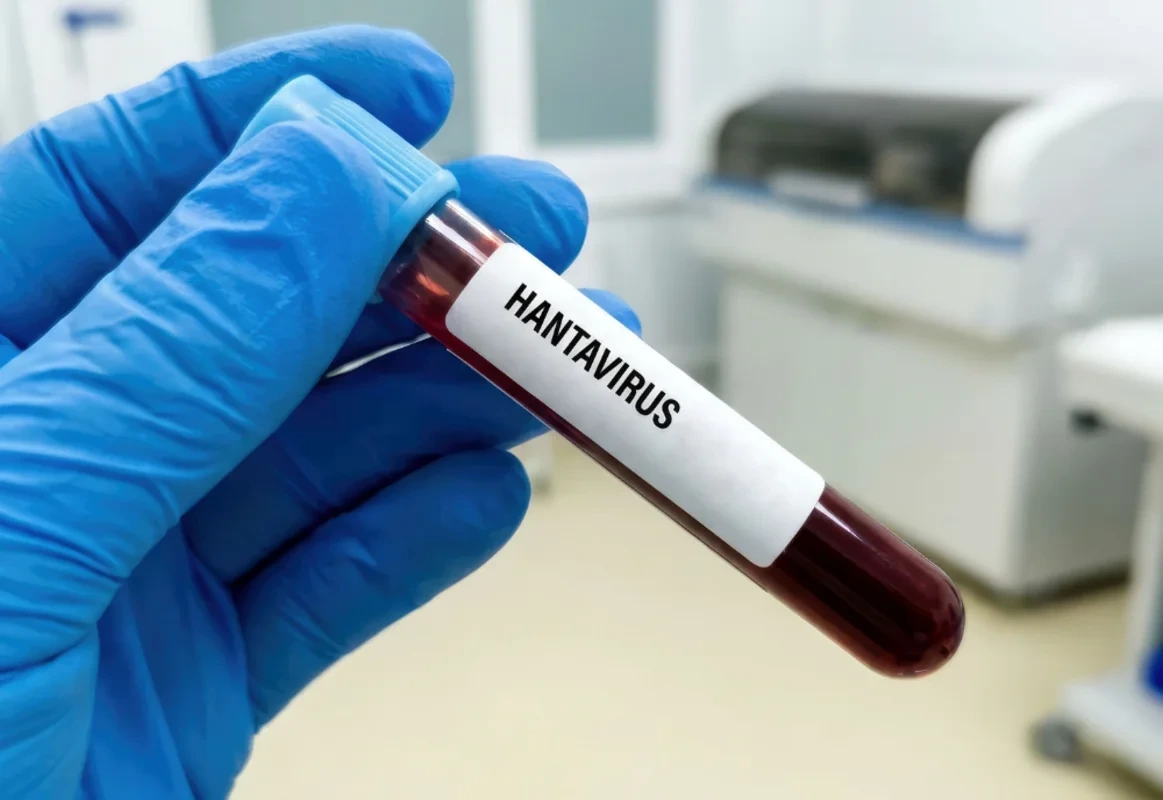 Asiyada hantavirusdan ilk ölüm halı qeydə alınıb