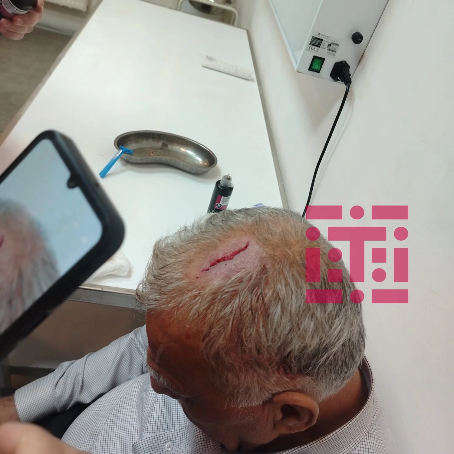 Şəkidə icra nümayəndəsi bələdiyyə sədrinin başına butulka çırpıb – TƏFƏRRÜAT/FOTO