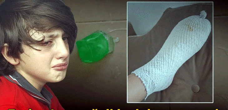 11 yaşlı uşağın əlində stres oyuncağı partladı: Ailə şikayət etdi
