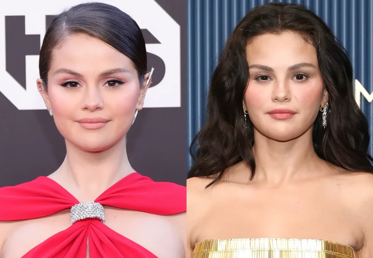 Selenanın üzünə nə olub? -FOTO