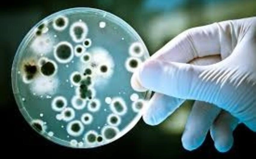 Belçikada Salmonella virusuna yoluxanların sayı 318-ə çatıb
